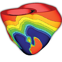 modelare computationala a unui model cardiac