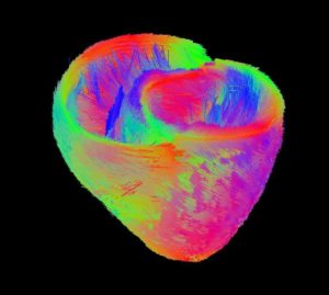 vizualizarea fibrei cardiace